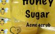 Exfoliante Facial de acne miel