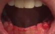 Cepillo de dientes con sangre