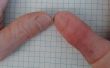 Prótesis de dedo pulgar