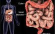 EII: La cura para el Crohn y la Colitis Ulcerativa