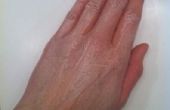 Invierno las manos remedio (piel seca)