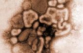 Cómo evitar la influenza A Virus H1N1