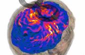 De imágenes de RM de campo eléctrico: modelado de la estimulación magnética transcraneal