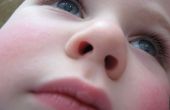 Eliminación del objeto pegado en la nariz del niño al vacío