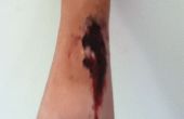 Cicatriz en brazo
