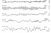 BRICOLAJE de EEG (y ECG) circuito